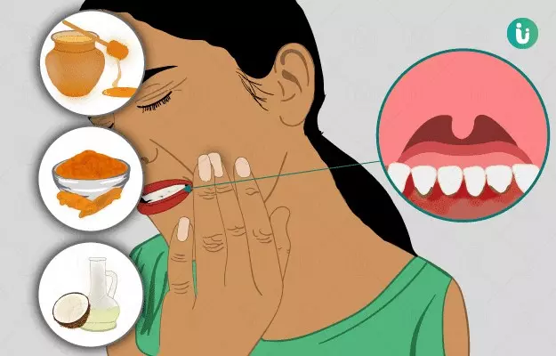 Home remedies for bleeding gums
