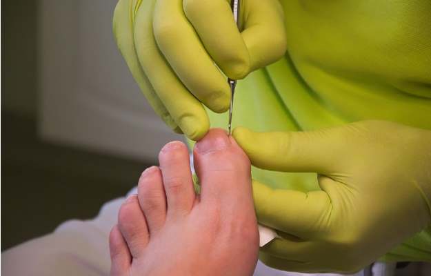 Foot care tips for diabetic patients