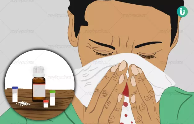 Homeopathic medicine, treatment and remedies for Nosebleed