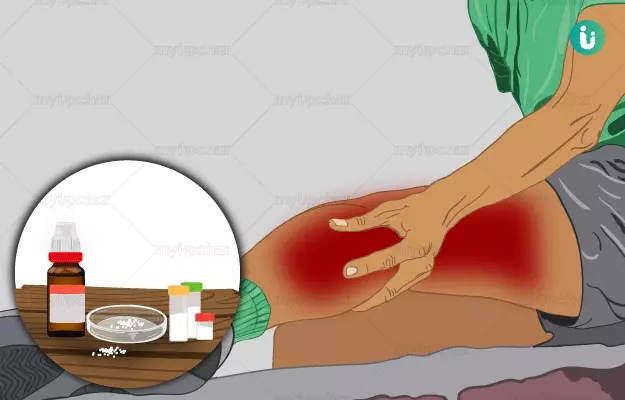 Homeopathic medicine, treatment and remedies for leg pain