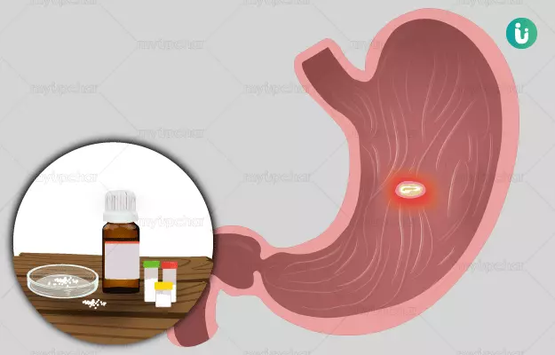 पेट में छाले की होम्योपैथिक दवा और इलाज - Homeopathic medicine and treatment for Peptic Ulcer in Hindi