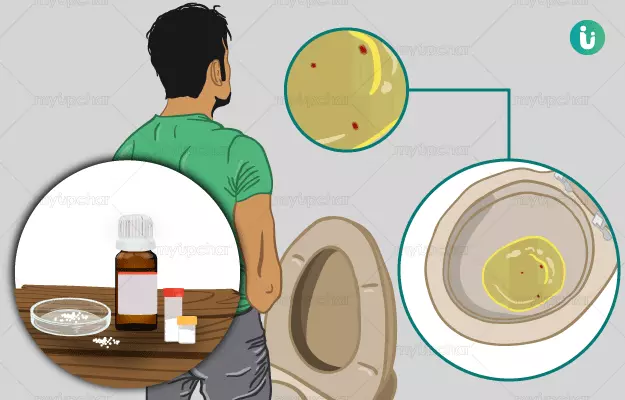 Homeopathic medicine, treatment and remedies for Blood in Urine