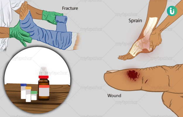 homeopathic-treatment-medicines-remedies-for-injury-types