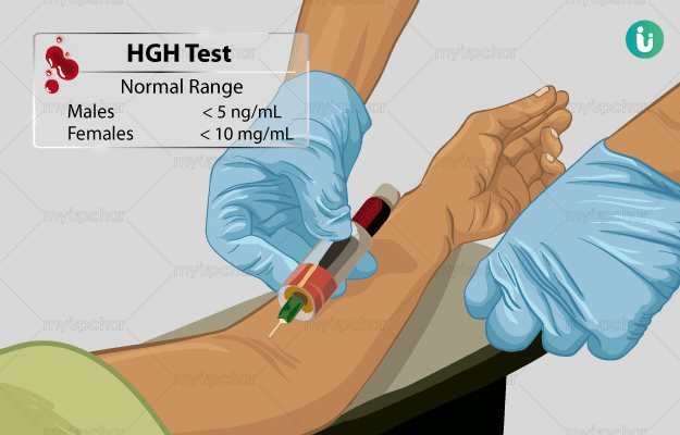 HGH testing and detection methods