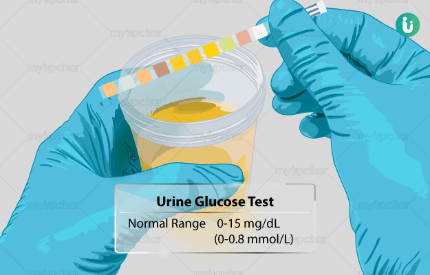 Urine for sugar test