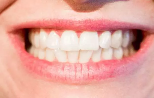 पीले दांतों को सफेद करने के उपाय - Home remedies for yellow teeth in Hindi