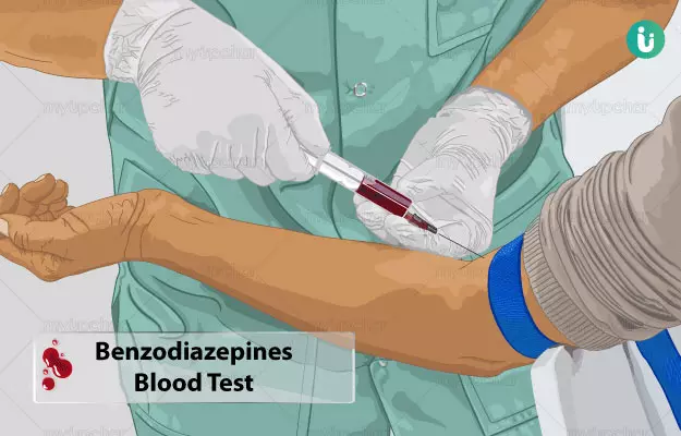 Benzodiazepines Blood Test Procedure Purpose Results Cost