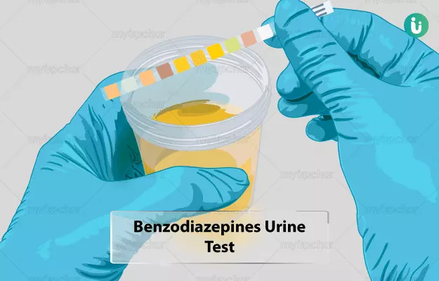 Benzodiazepines Urine Test Procedure Purpose Results Cost