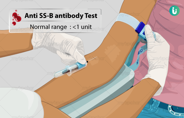 Anti SS-B Antibody Test: Procedure, Purpose, Results, Normal Range ...