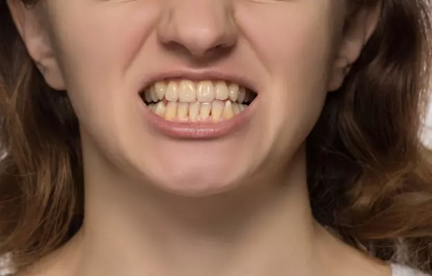 इन वजहों से आपके दांत भी पड़ सकते हैं पीले, सावधान रहें