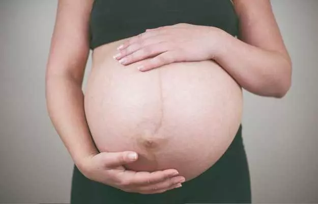 गर्भावस्था के बाद खिंचाव के निशान को दूर करने का आयुर्वेदिक समाधान - Ayurvedic Remedies for pregnancy stretch marks in Hindi