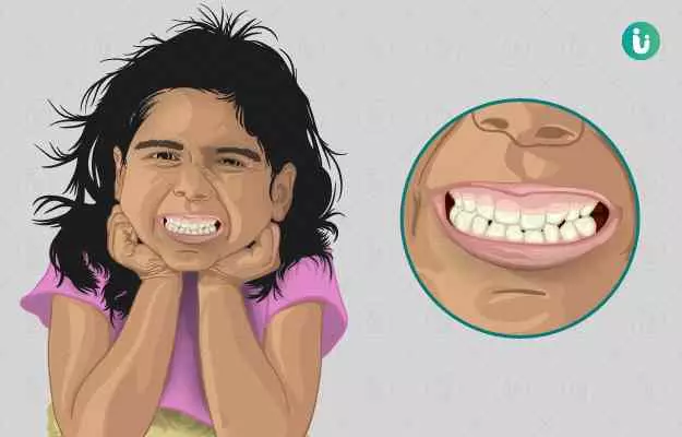 क्या आपके घर में भी कोई दांत पीसता है, ये हो सकती है वजह