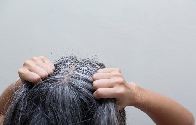 White hair: Causes and ways to prevent it