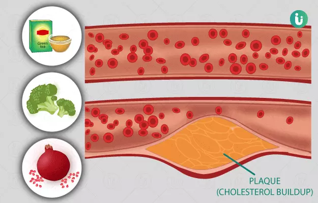 Home remedies for atherosclerosis