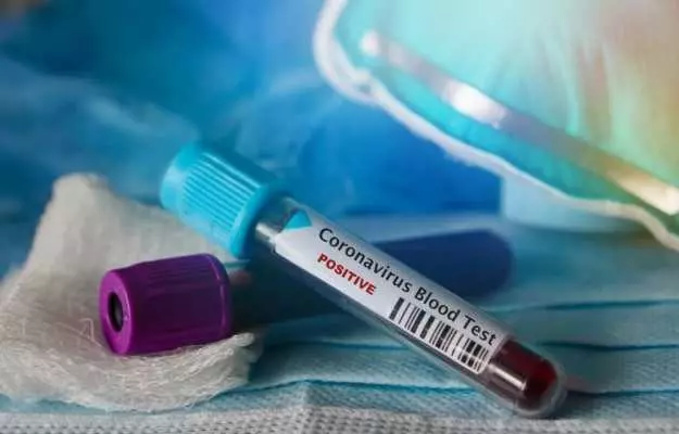 कोरोना वायरस: चीन में नए मरीजों की संख्या में कमी, एशिया के बाहर पहली मौत की पुष्टि