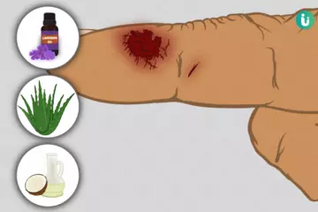 How to Heal Wounds Naturally: Effective Home Remedies