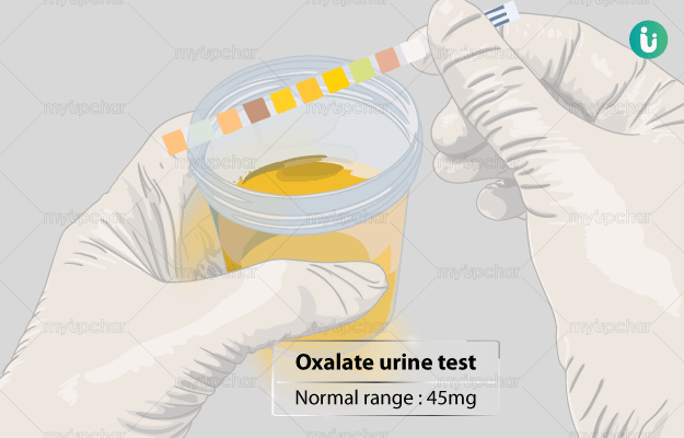 Oxalate urine test: Procedure, Purpose, Results, Normal range, Cost ...