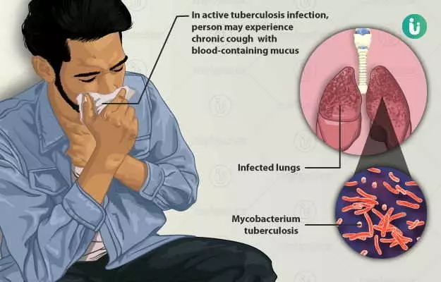 वर्ल्ड ट्यूबरकुलोसिस डे: दुनिया की सबसे जानलेवा बीमारियों में से एक है टीबी, जानें भारत में हर साल कितने लोगों की होती है मौत